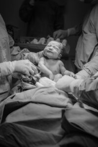 A newborn baby in a hospital delivery room, surrounded by medical practitioners during childbirth.